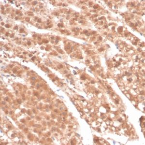Formalin-fixed, paraffin-embedded human adrenal gland stained with Aldose Reductase Recombinant Mouse Monoclonal Antibody (rAKR1B1/7295). HIER: Tris/EDTA, pH9.0, 45min. 2 °: HRP-polymer, 30min. DAB, 5min.