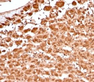 Formalin-fixed, paraffin-embedded human adrenal gland stained with Aldose Reductase Recombinant Mouse Monoclonal Antibody (rAKR1B1/7296). HIER: Tris/EDTA, pH9.0, 45min. 2 °: HRP-polymer, 30min. DAB, 5min.