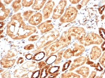 Formalin-fixed, paraffin-embedded human kidney stained with Aldose Reductase Recombinant Rabbit Monoclonal Antibody (AKR1B1/7010R). HIER: Tris/EDTA, pH9.0, 45min. 2°C: HRP-polymer, 30min. DAB, 5min. Recombinant Aldo-keto Reductase Family 1 Member B1 (Adrenal Marker) Antibody