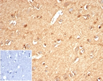 IHC analysis of formalin-fixed, paraffin-embedded human brain. Staining using AKR1B1/7010R at 2ug/ml in PBS for 30min RT. Inset: PBS instead of primary antibody; secondary only negative control.