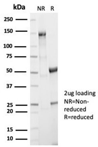 SDS-PAGE Analysis of Purified AKR1B1 Rabbit Monoclonal Antibody (AKR1B1/7010R). Confirmation of Purity and Integrity of Antibody.
