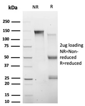 SDS-PAGE Analysis  Purified HIC2 Mouse Monoclonal Antibody (PCRP-HIC2-1B1). Confirmation of Purity and Integrity of Antibody.
