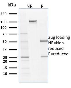 SDS-PAGE Analysis of Purified Filaggrin Monoclonal Antibody (SPM181). Confirmation of Purity and Integrity of Antibody.