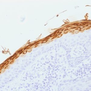 Formalin-fixed, paraffin-embedded human Skin stained with Filaggrin Mouse Monoclonal Antibody (FLG/1562).