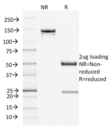 SDS-PAGE Analysis of Purified Filaggrin Mouse Monoclonal Antibody (FLG/1945). Confirmation of Integrity and Purity of Antibody.