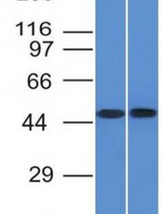 Western Blot of THP1 and Raji cell lysate using FLI1 Monoclonal Antibody (FLI1/1312)