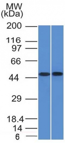 Western Blot of THP1 and Raji cell lysate using FLI1 Monoclonal Antibody (FLI1/1312)