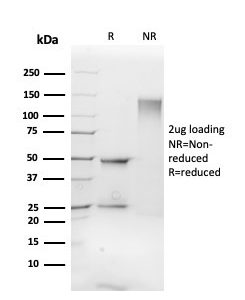 SDS-PAGE Analysis Purified Fli1 Mouse Monoclonal Antibody (FLI1/3183). Confirmation of Purity and Integrity of Antibody.