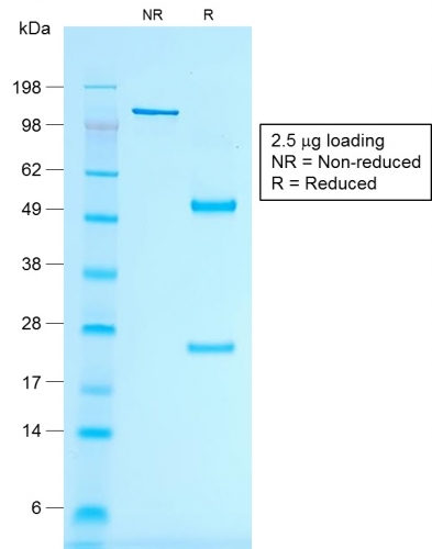 SDS-PAGE Analysis of Purified MART-1 Mouse Recombinant Monoclonal Antibody (rMLANA/788). Confirmation of Purity and Integrity of Antibody.