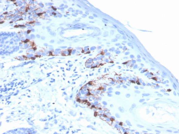 Formalin-fixed, paraffin-embedded human skin stained with  MART-1 Recombinant Mouse Monoclonal Antibody (rMLANA/4576).