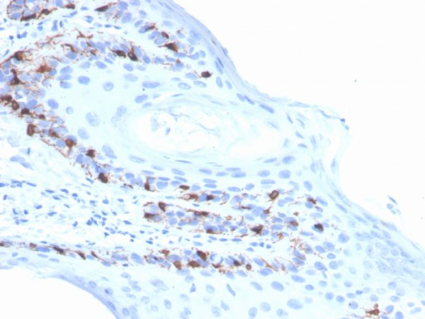 Formalin-fixed, paraffin-embedded human skin stained with  MART-1 Recombinant Mouse Monoclonal Antibody (rMLANA/4576).