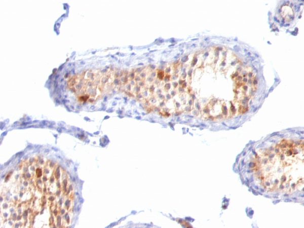 Formalin-fixed, paraffin-embedded human Testis stained with MART-1 / Melan-A Monoclonal Antibody (A103+M2-7C10+M2-9E3).