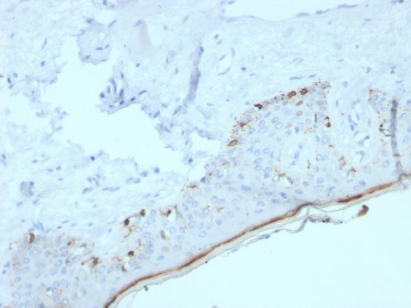 Formalin-fixed, paraffin-embedded human skin stained with MART-1 Recombinant Rabbit Monoclonal Antibody (MLANA/4385R).