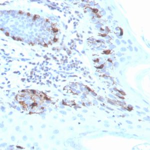 Formalin-fixed, paraffin-embedded human skin stained with MART-1 Recombinant Rabbit Monoclonal Antibody (MLANA/4475R).