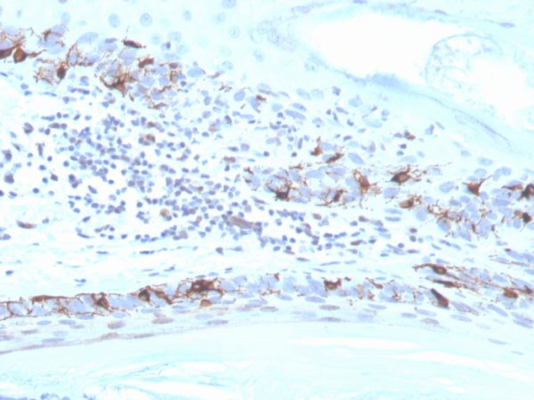 Formalin-fixed, paraffin-embedded human skin stained with MART-1 Recombinant Rabbit Monoclonal Antibody (MLANA/4475R).