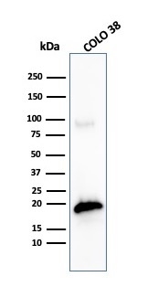 Western blot analysis of COLO-38 cell lysate using MART-1 Recombinant Rabbit Monoclonal Antibody (MLANA/4475R).