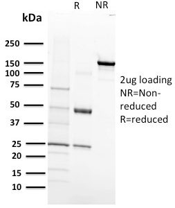 SDS-PAGE Analysis of Purified VEGF-R1 Mouse Monoclonal Antibody (FLT1/658). Confirmation of Integrity and Purity of Antibody.