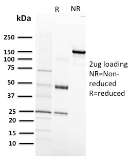 SDS-PAGE Analysis of Purified VEGF-R1 Mouse Monoclonal Antibody (FLT1/658). Confirmation of Integrity and Purity of Antibody.