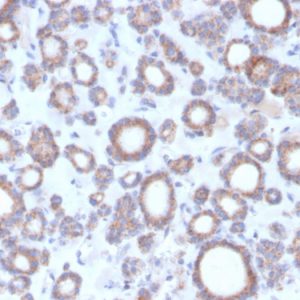 Formalin-fixed, paraffin-embedded human thyroid stained with DBC2 Mouse Monoclonal Antibody (DBC2/3364).