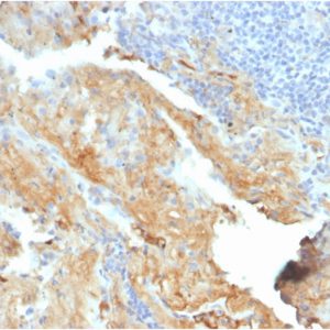 Formalin-fixed, paraffin-embedded human lung stained with Fibronectin Mouse Monoclonal Antibody (FN1/2950).