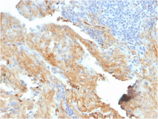 Formalin-fixed, paraffin-embedded human lung stained with Fibronectin Mouse Monoclonal Antibody (FN1/2950).