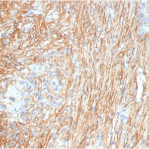 Formalin-fixed, paraffin-embedded human lung stained with Fibronectin Mouse Monoclonal Antibody (FN1/3036).