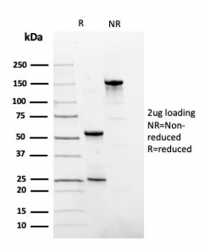 SDS-PAGE Analysis of Purified Fibronectin Mouse Monoclonal Antibody (FN1/3036). Confirmation of Integrity and Purity of Antibody.