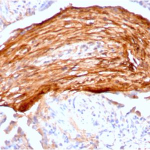 Formalin-fixed, paraffin-embedded human lung stained with Fibronectin Mouse Monoclonal Antibody (FN1/3045).