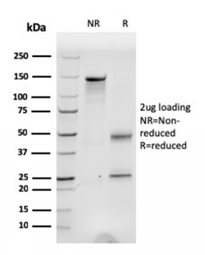 SDS-PAGE Analysis of Purified Fibronectin Mouse Monoclonal Antibody (C6F10). Confirmation of Integrity and Purity of Antibody.