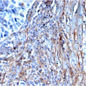 Formalin-fixed, paraffin-embedded human lung stained with Fibronectin Mouse Monoclonal Antibody (FN1/3568).