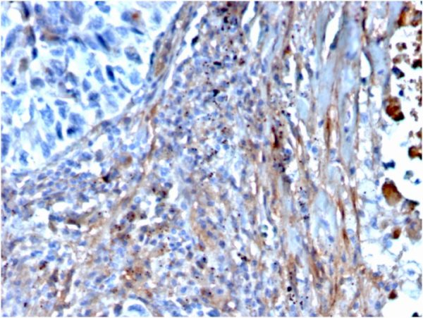 Formalin-fixed, paraffin-embedded human lung stained with Fibronectin Mouse Monoclonal Antibody (FN1/3568).