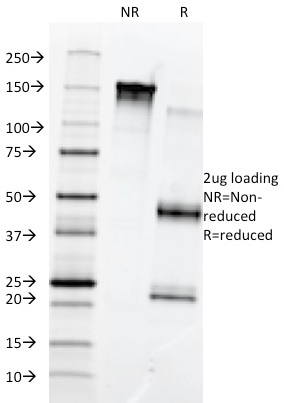 SDS-PAGE Analysis of Purified Fibronectin Monoclonal Antibody (568). Confirmation of Purity and Integrity of Antibody.