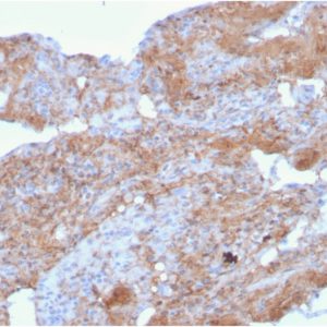 Formalin-fixed, paraffin-embedded human lung stained with Fibronectin Mouse Monoclonal Antibody (FN1/2948).
