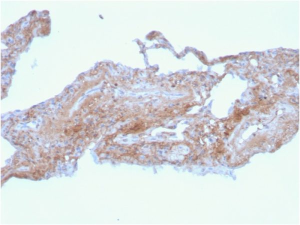 Formalin-fixed, paraffin-embedded human lung stained with Fibronectin Mouse Monoclonal Antibody (FN1/2948).