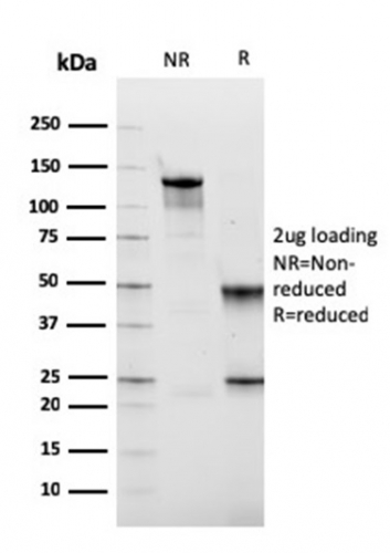 SDS-PAGE Analysis of Purified Fibronectin Mouse Monoclonal Antibody (FN1/2949). Confirmation of Integrity and Purity of Antibody.
