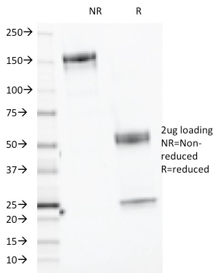 SDS-PAGE Analysis Purified CELA3B Monoclonal Antibody (CELA3B/1218). Confirmation of Purity and Integrity of Antibody.