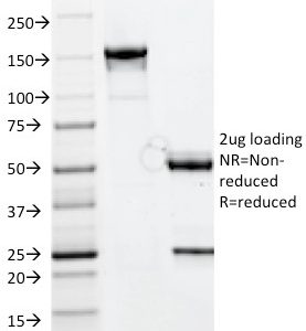 SDS-PAGE Analysis of Purified CELA3B Mouse Monoclonal Antibody (CELA3B/1811). Confirmation of Purity and Integrity of Antibody.