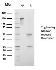 SDS-PAGE Analysis of Purified CELA3B Recombinant Mouse Monoclonal Antibody (rCELA3B/1811). Confirmation of Purity and Integrity of Antibody.