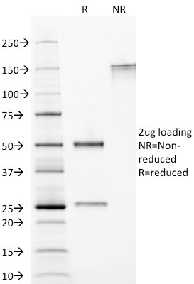 SDS-PAGE Analysis Purified CELA3B / ELA3B Monoclonal Antibody (CELA3B/1374). Confirmation of Purity and Integrity of Antibody.