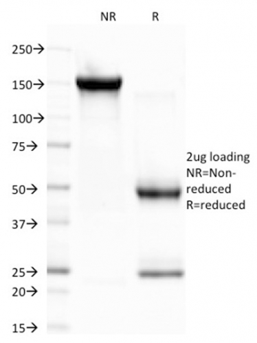 SDS-PAGE Analysis Purified CELA3B Monoclonal Antibody (CELA3B/1757). Confirmation of Purity and Integrity of Antibody.