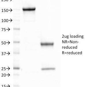 SDS-PAGE Analysis of Purified CELA3B Mouse Monoclonal Antibody (CELA3B/1758). Confirmation of Purity and Integrity of Antibody.