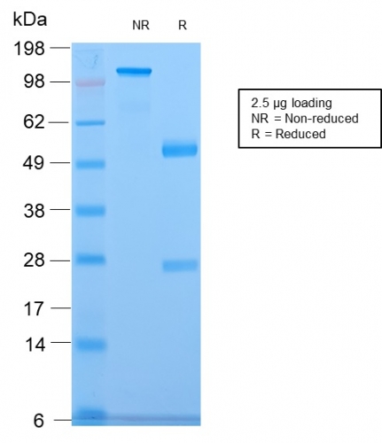 SDS-PAGE Analysis of Purified CELA3B Rabbit Recombinant Monoclonal Antibody (CELA3B/2809R). Confirmation of Purity and Integrity of Antibody.