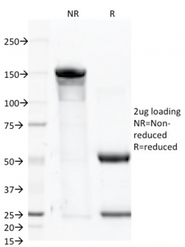 SDS-PAGE Analysis Purified FOLH1 (PSMA) Mouse Monoclonal Antibody (FOLH1/2363). Confirmation of Purity and Integrity of Antibody.