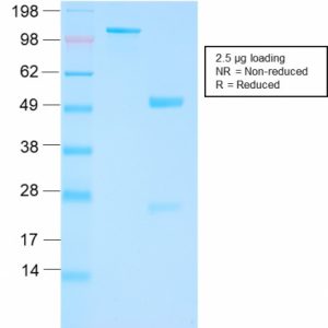 SDS-PAGE Analysis of Purified FOLH1 Rabbit Recombinant Monoclonal Antibody (FOLH1/3149R). Confirmation of Purity and Integrity of Antibody.