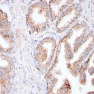 Recombinant FOLH1 / PSMA (Prostate Epithelial Marker) Antibody