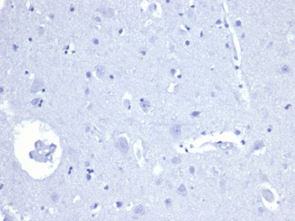 IHC analysis of formalin-fixed, paraffin-embedded human brain. Negative tissue control using rAMACR/4674 at 2ug/ml in PBS for 30min RT. HIER: Tris/EDTA, pH9.0, 45min. 2°C: HRP-polymer, 30min. DAB, 5min.