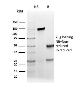 SDS-PAGE Analysis Purified AMACR Recombinant Mouse Monoclonal Antibody (rAMACR/6369). Confirmation of Purity and Integrity of Antibody.