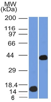 Western Blot (1) Recombinant AMACR and (2) Human Kidney lysate using AMACR / p504S Mouse Monoclonal Antibody (AMACR/1864).