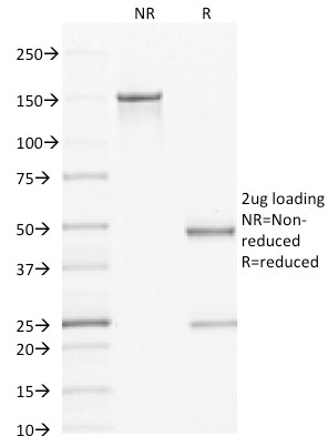 SDS-PAGE Analysis Purified AMACR / p504S Mouse Monoclonal Antibody (AMACR/1864). Confirmation of Integrity and Purity of Antibody.