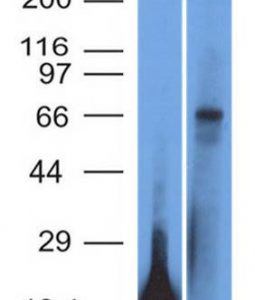 Western Blot Analysis of TRIM29 Recombinant protein fragment & A431 cell lysate TRIM29 Monoclonal Antibody (TRIM29/1042).